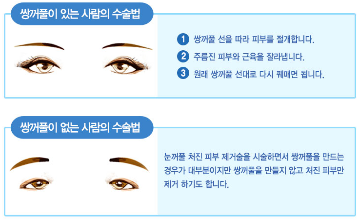 이미지명