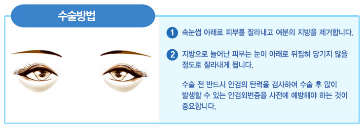 이미지명