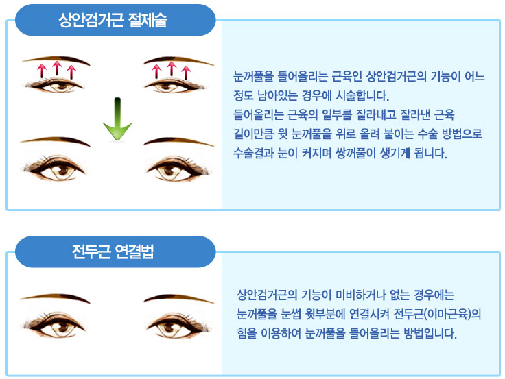 이미지명